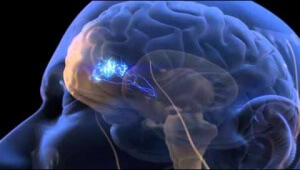 المخ يعالج و يرسل الاحساس بالألم لمختلف أجزاء الجسم و لكنه لا يحس بالالم نفسه.